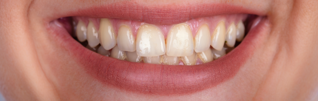 BEFORE DENTAL TREATMENT BEFORE DENTAL TREATMENT